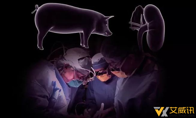 动物器官移植人体再进一步，猪肾在脑死亡患者体内撑过1个月